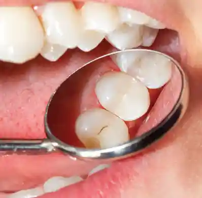 Preventative Dental Care